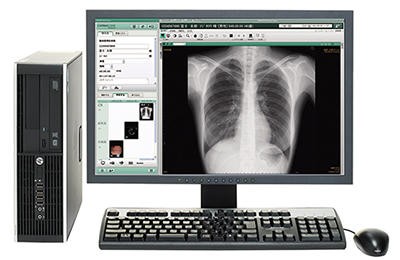 胸部レントゲン検査(DRシステム:富士フィルム)