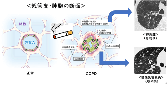 気管支・肺胞の断面